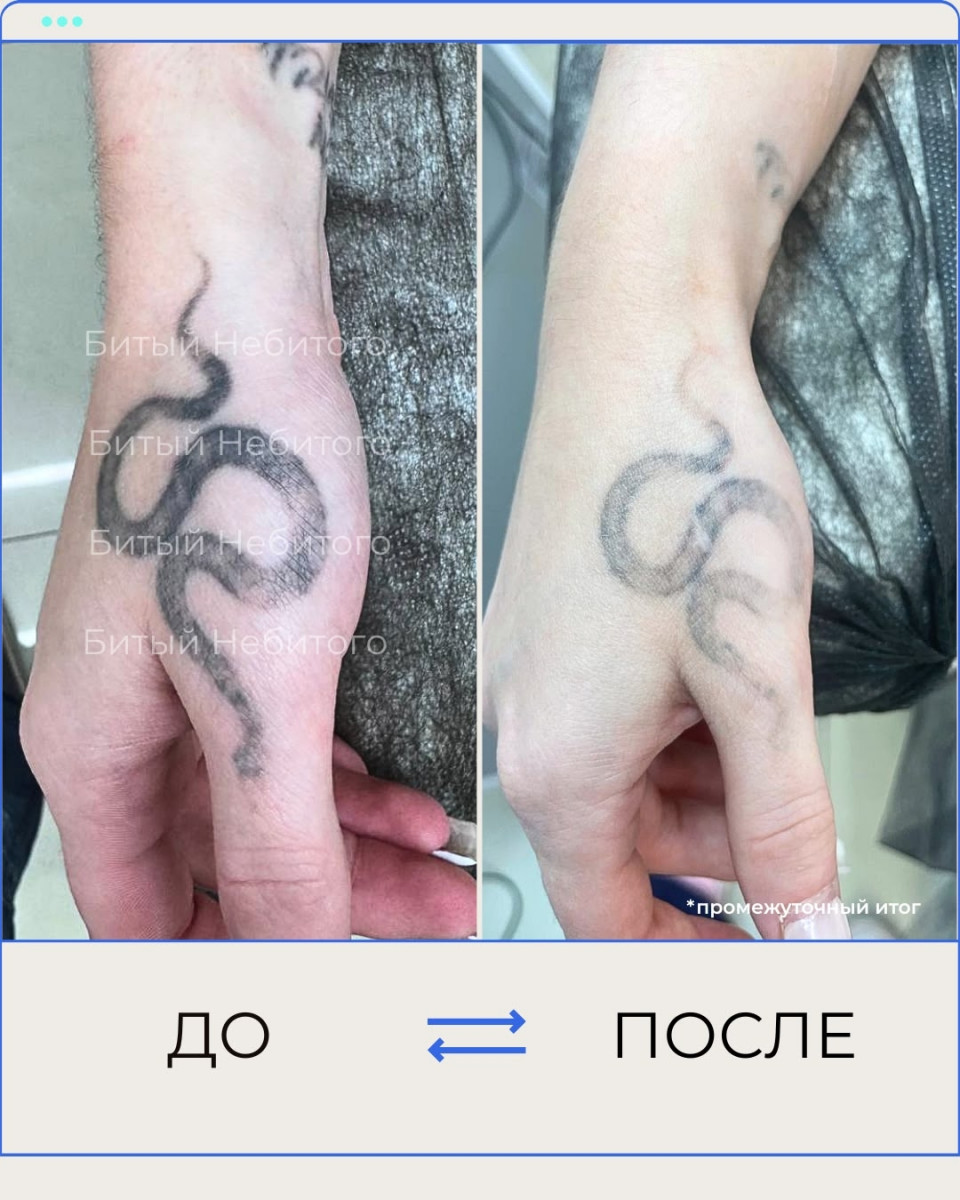 Сведение тату змея на руке
